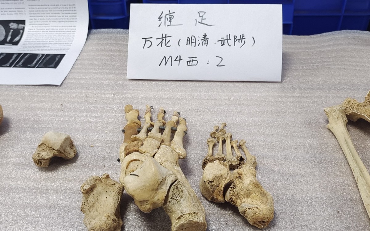 文明探源 出彩中原丨双槐树男人“不干活”，<br>听人骨告诉你的三两事